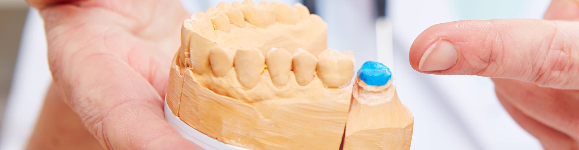 Hands of dental technician showing dentures with crown